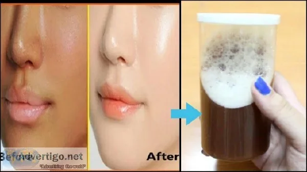 Learn How to Make Whitening Face Wash by itself