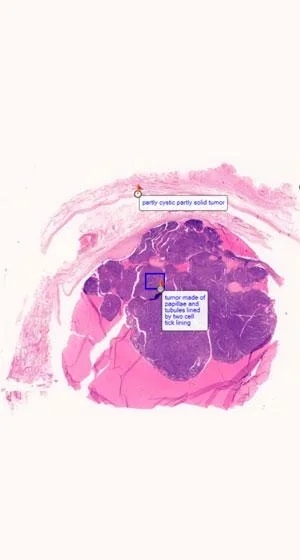 Searching for the Best Dermatopathology services in Delhi NCR In