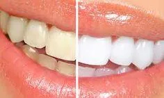 Top Gum Specialist Dentist in Manhattan NYC