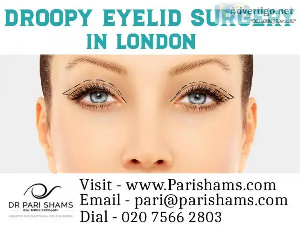 Droopy Eyelid Surgery In London - Dr. Pari Shams