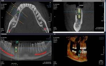 WORKSHOP ON CONE BEAM COMPUTED TOMOGRAPHY