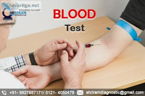 Best blood testing lab