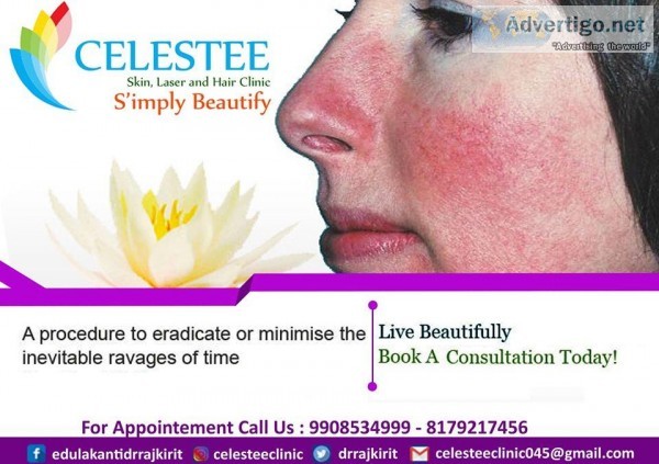 best skin specialist for psoriasis in hyderbad