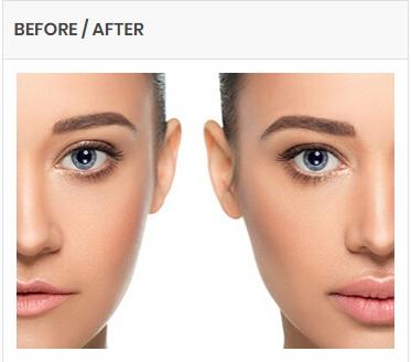 best botox skin treatment in hyderabad