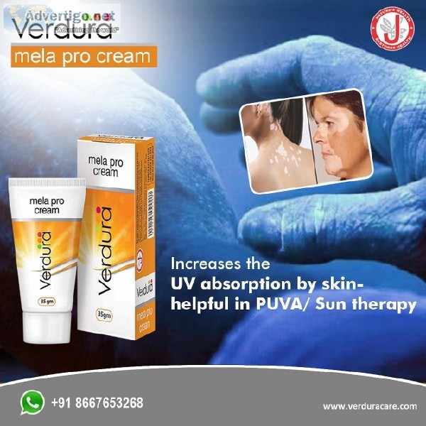 Vitiligo Cream With SUN and PUVA Therapy Benefits