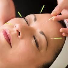 Chinese Acupuncture Training
