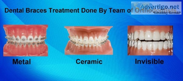 Show Your Dental Problem at best Dental implant in kolkata