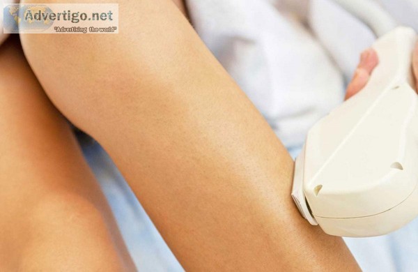 Say Goodbye to Your Razor with Laser Hair Removal