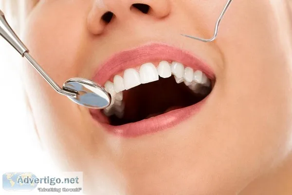 Comprehensive Teeth Cleaning Service in Griffin