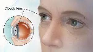 Dr. Leo Ayzenberg MD Eye Clinic Optical Boutique Eye Surgery Cli