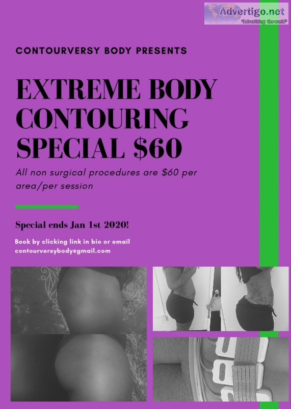 Mobile Non Surgical Body Contouring