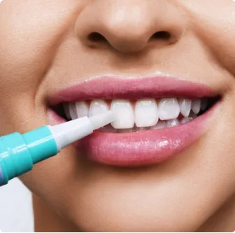 Find Teeth whitening in Gilbert AZ- SofTouch Dental Care