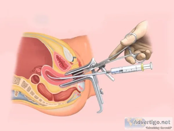 Best IUI Treatment Centre
