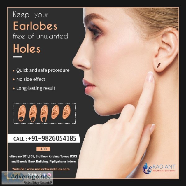 Ear lobe repairing treatment in Indore