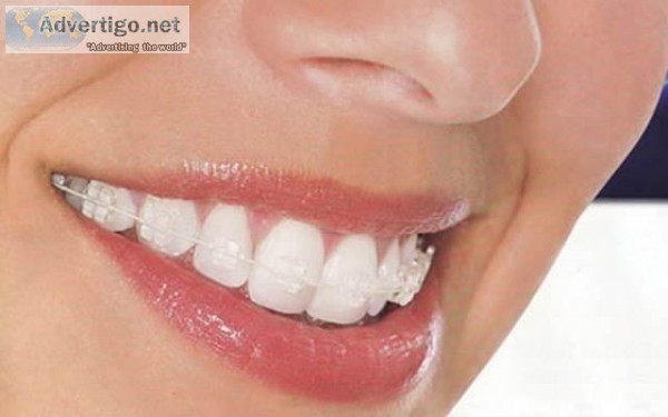 Cosmetic Dental Clinic in Gurgaon