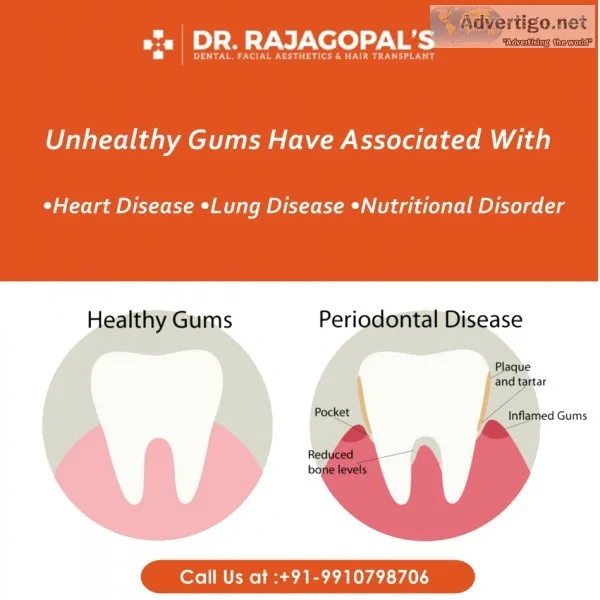 Child Dentist in Gurgaon