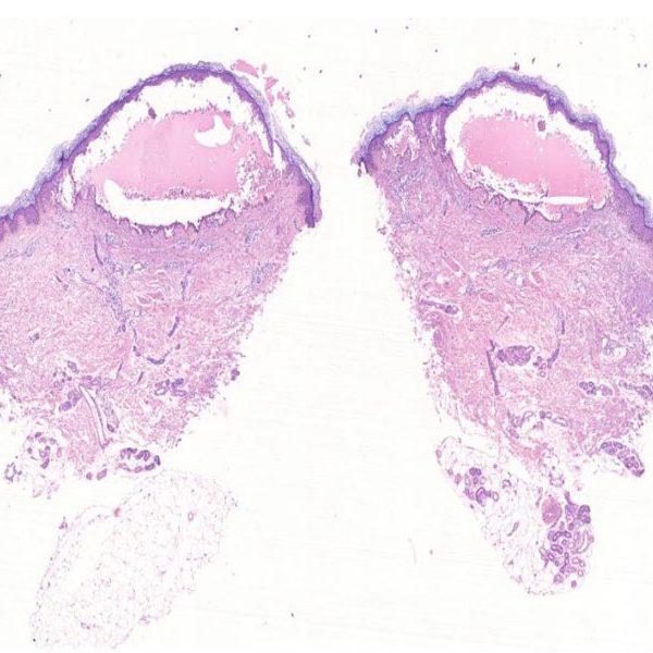 Want the Best Dermatopathology slides services in Delhi NCR Indi