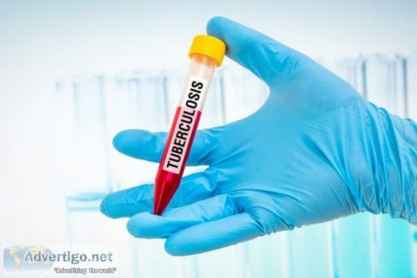 Get tuberculosis test done at Dr Lal PathLabs