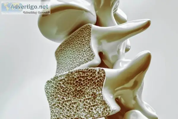 Get Osteoporosis Treatment from Orthopedic Doctors