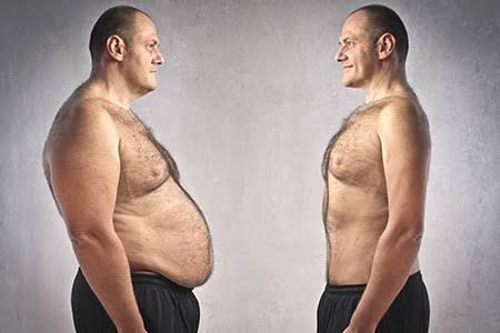 Shed The Pounds With Bariatic Surgery In Kolkata