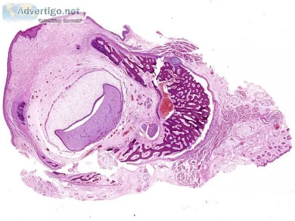Looking for Best Oral histology services in Delhi NCR India