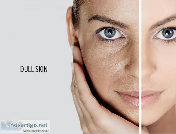 SMUK offer Dull Skin Treatment in Delhi India