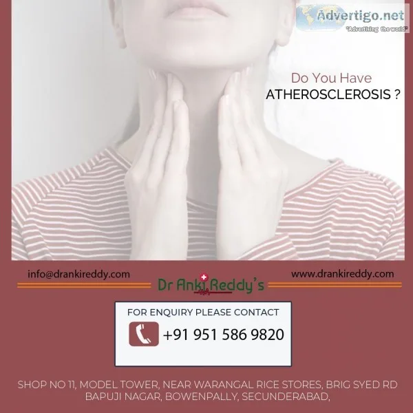 homeopathy for anxiety