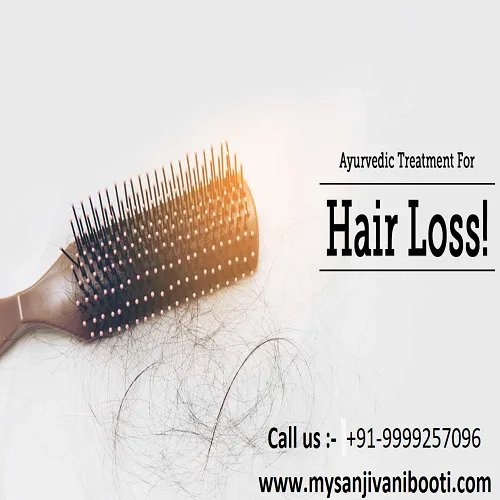 What is hair loss and how to prevent it with ayurvedic products