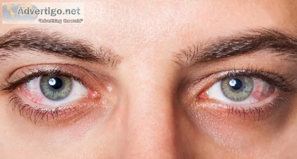 Lasik Eye Surgery Cost