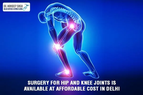 Surgery for hip and knee joints is available at affordable cost 