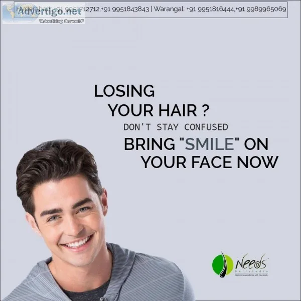best hair replacement