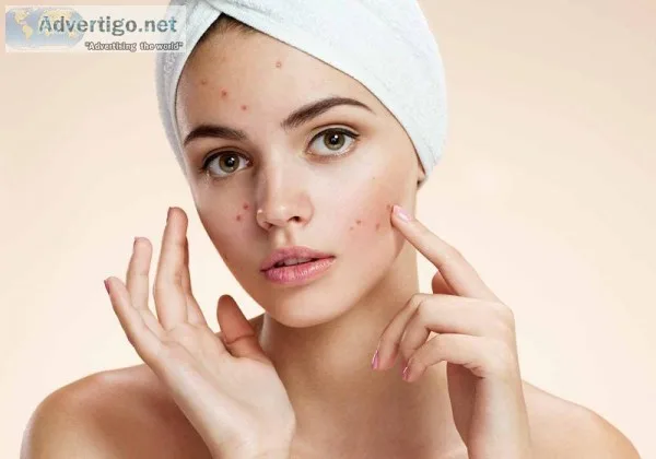 Acne Treatment In Bhubaneswar