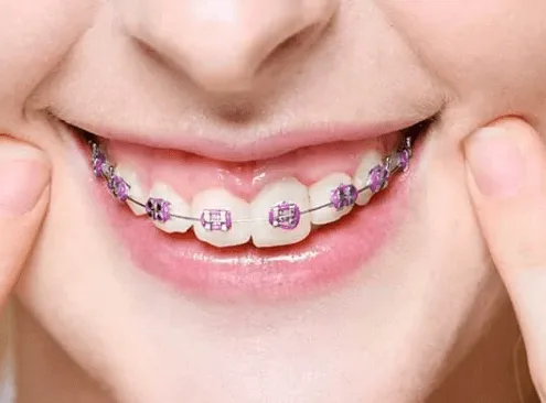 Livermore orthodontist