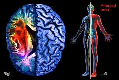 Spine Care Treat Your Spine Related Problems With Parijatak Ayur