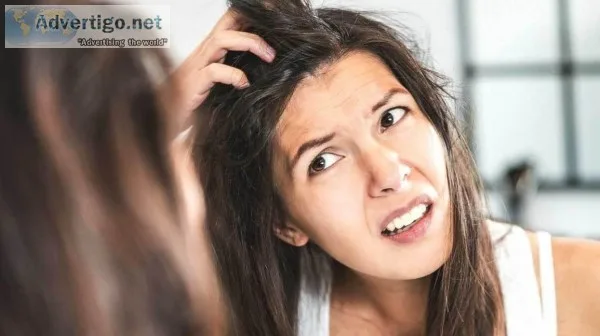 Best Dandruff Solution in Delhi at SMUK