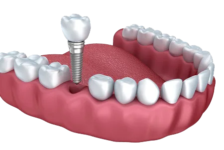 Dental clinic in Bareilly  dentist in bareilly