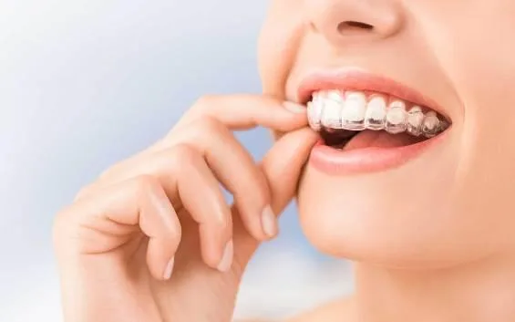Invisalign Chadstone  Huntingdale Dental Centre