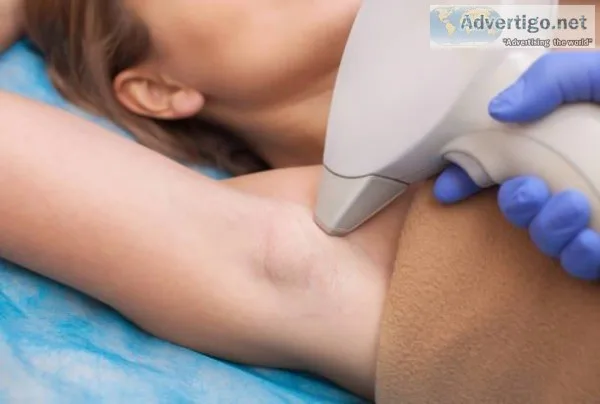 Get Laser Technique for Unwanted Hair Removal at Medispa