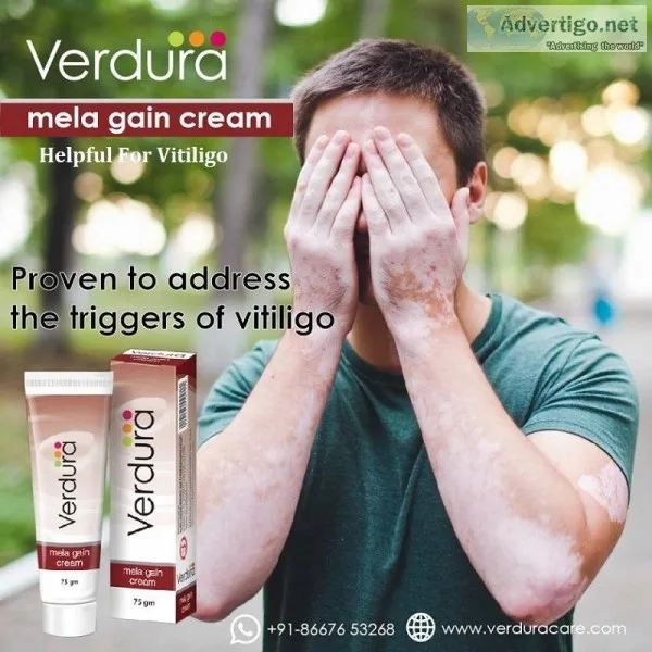 Cream For Vitiligo