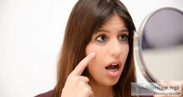 How To Get Rid Of Dark Circles