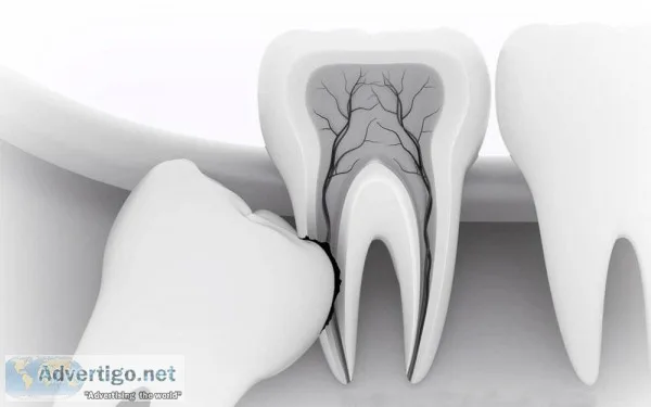 BEST MINOR ORAL SURGERY and MEDICAL EMERGENCIES COURSE IN HYDERA