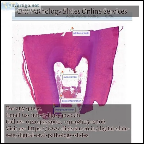 Best Oral pathology slides services in Delhi  India