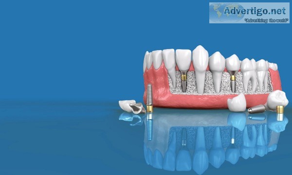 Windham Dental Implants  Lifetimedentalhealth .com