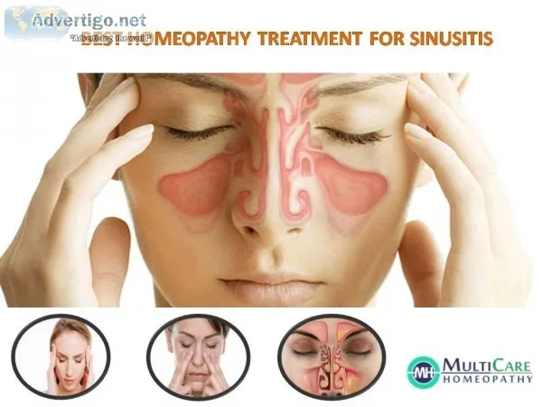 6 Best homeopathic Medicines for Sinusitis Treatment.