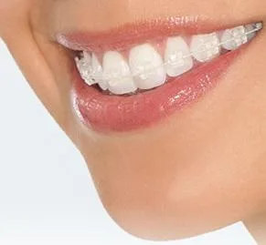 Dentist Goose Creek SC  Acuityortho.com