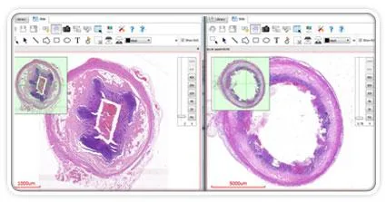 Looking for the Best Non Gynae Cytology Slides online services i