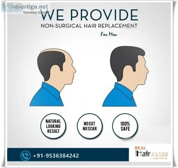 Hair Patch in Gurgaon