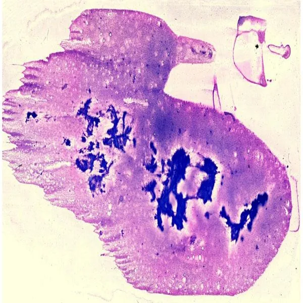 Cytology Slides