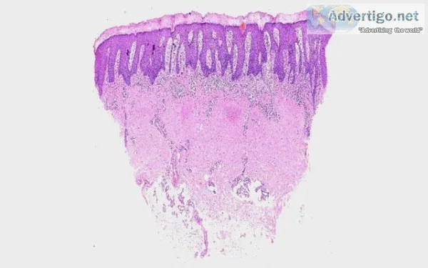 Dermatopathology slides