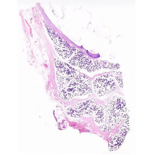 Quiz Cases